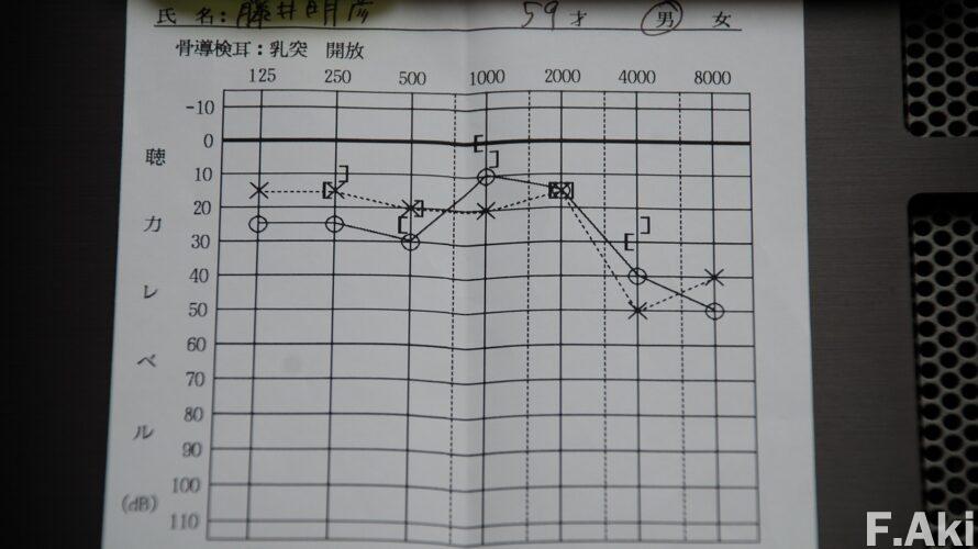 オーディオ・ベースマン見たり聴いたり　聴力検査・・やはり老化は避けられないね。